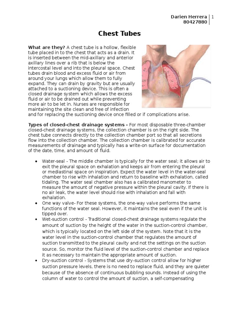 Chest Tube Management and Procedures | PDF | Respiratory System ...