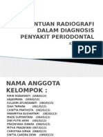 Bantuan Radiografi Dalam Diagnosa Penyakit Periodontal