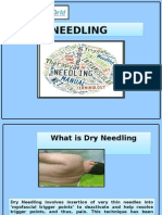 Dry Needling