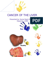 Cancer of The Liver: Presented By: Nurse Paolo Rafael D. Esguerra, USRN