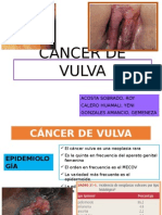 Cáncer de Vulva