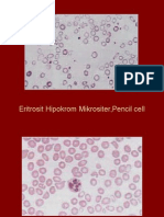 Eritrosit Hipokrom Mikrositer, Pencil Cell