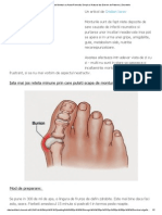 Cum Scapi de Monturi Cu Acest Remediu Simplu Si Natural Dar Extrem de Puternic - Secretele