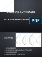 Ectasias Corneales