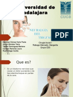 Neuralgia de Trigemino