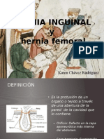 Hernias inguinales y femorales