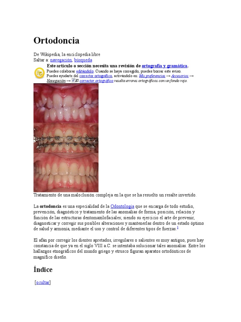 Ortodoncia | PDF | Ortodoncia | Ramas de Odontología