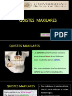 13. QUISTES  maxilares