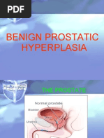Download Benign Prostatic Hyperplasia by tabangin_hilario SN28184029 doc pdf
