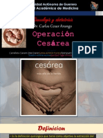 Operacion Cesarea