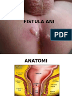 Fistula Ani