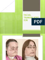 Facial Transplatation Diapositivas