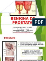 Hiperplasia Benigna Prostatica