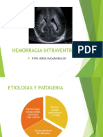 Hemorragía Intraventricular