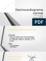 Electrocardiograma Normal