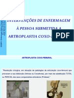 Artroplastia Coxo-Femural PDF