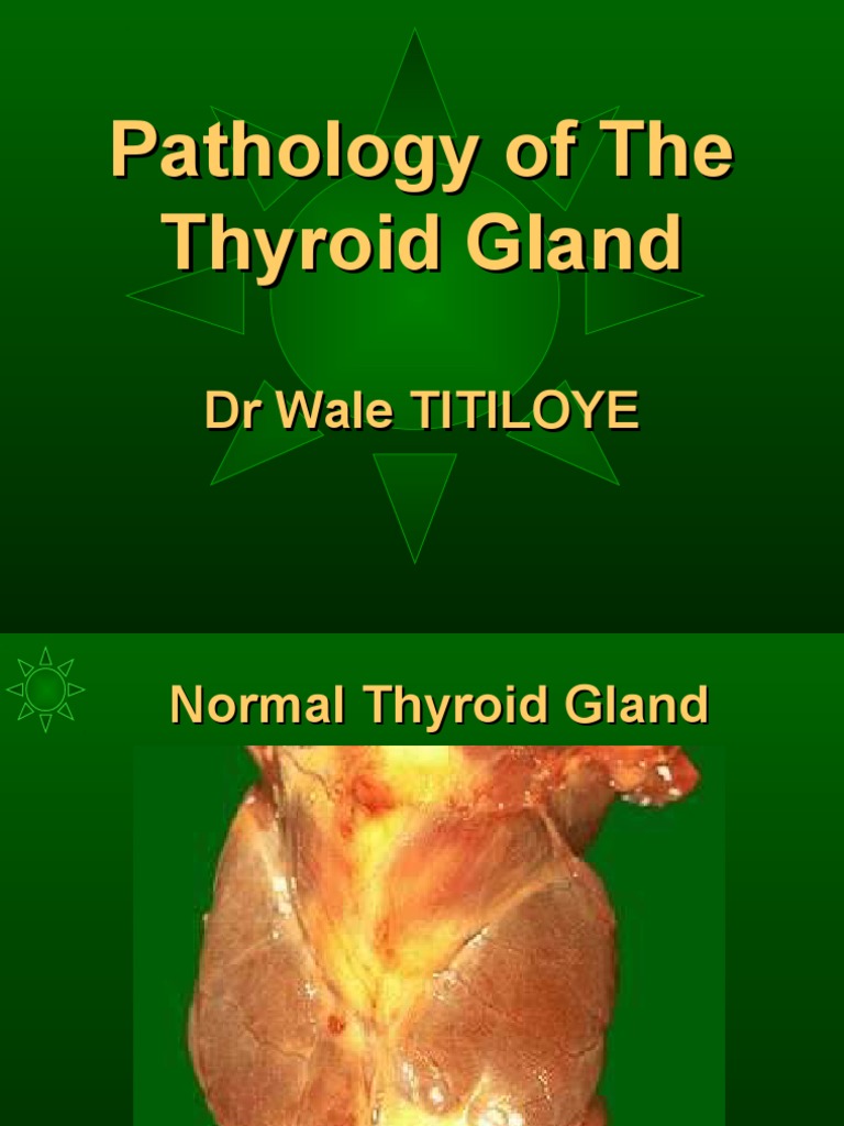 Pathology of Thyroid | PDF | Thyroid | Hyperthyroidism