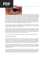 Download Jenis Penyakit Mata by dianaps SN282329886 doc pdf