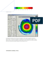 Paquimetria Topografia Corneal