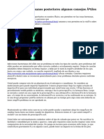 Mantener Tus Ojos Sanos Posteriores Algunos Consejos Útiles