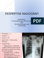 EKSPERTISE RADIOGRAFI