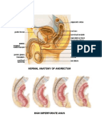 Normal Anatomy of Anorectum