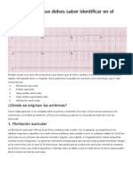 Las 5 Arritmias Que Debes Saber Identificar en El ECG