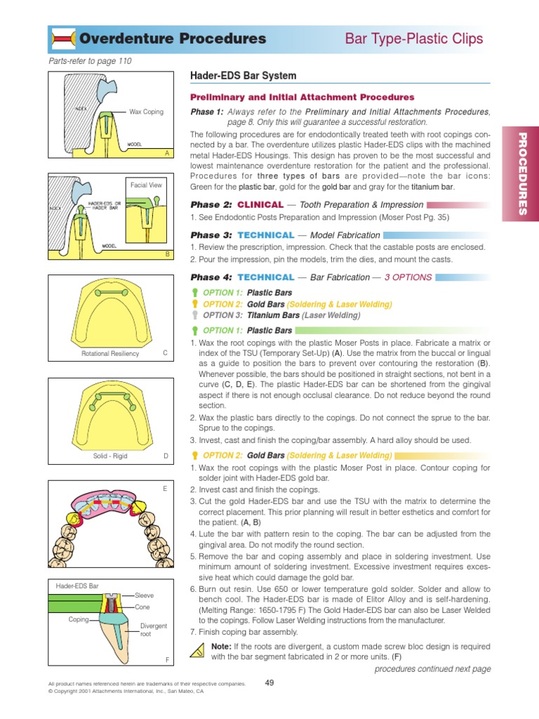 Overdenture | PDF | Soldering | Dentures