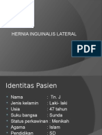 Hernia Inguinalis Lateral