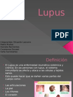 Lupus.pptx