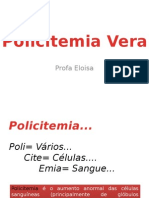 Policitemia Vera: Causas, Sintomas e Diagnóstico