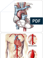 Aorta Abdominal (Irrigación de Órganos)