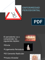 Enfermedad Periodontal2p