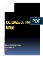 Torax Normal ..radiografías