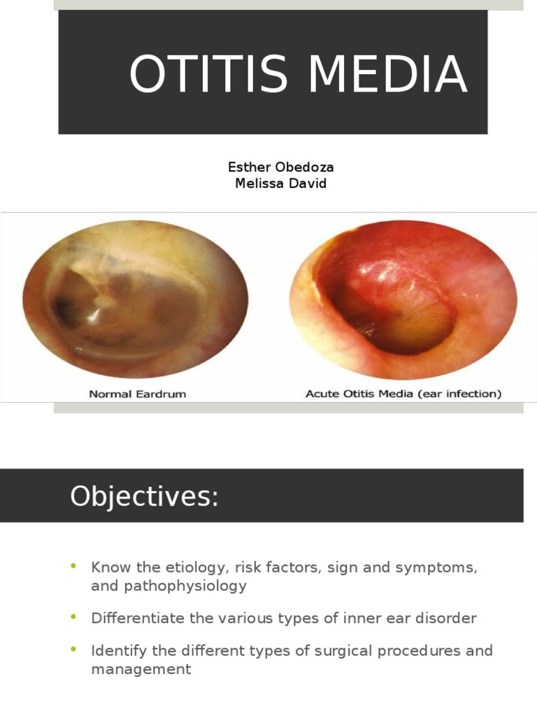 Otitis Media Ear Otorhinolaryngology