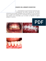 Enfermedades Del Aparato Digestivo