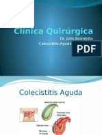Colecistitis Aguda Calculosa - Diagnóstico y Tratamiento