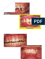 enfermedades periodontales.docx