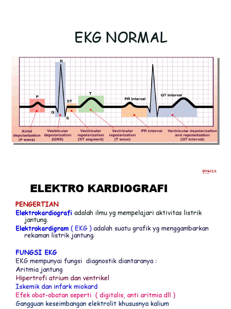 Download 580 Gambar Grafik Ekg Normal Paling Baru HD