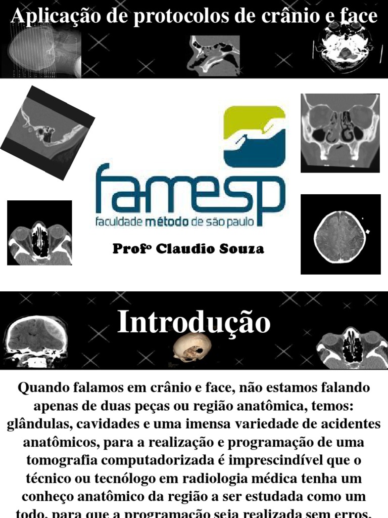 1 Protocolos Protocolos Tc Cranio E Face Tc Cranio E Face Pdf