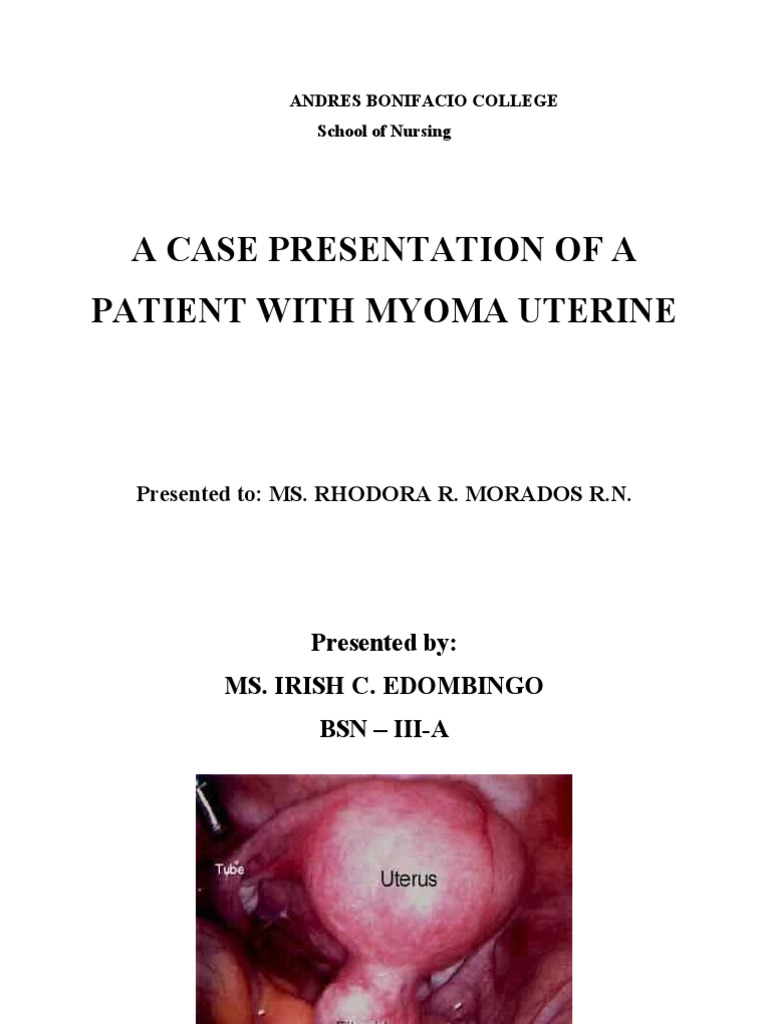 Case Study: Uterine Myoma Overview | PDF | Uterus | Neoplasms