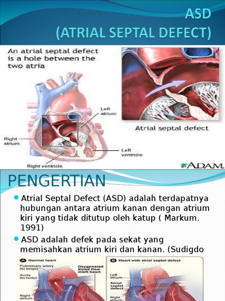 Definisi dan Penanganan ASD pada Anak | PDF