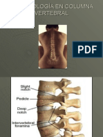 15247996-imagenologia-en-columna-vertebral-101215230221-phpapp01.ppt