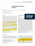 Avances en la fisiopatología del edema