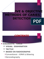 Subjective & Objective Methods of Caries Detection