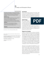 Neuroblastoma PDF