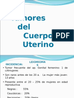 Tumores Del Cuerpo Uterino 2015