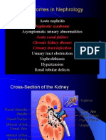 Nephrotic Syndrome