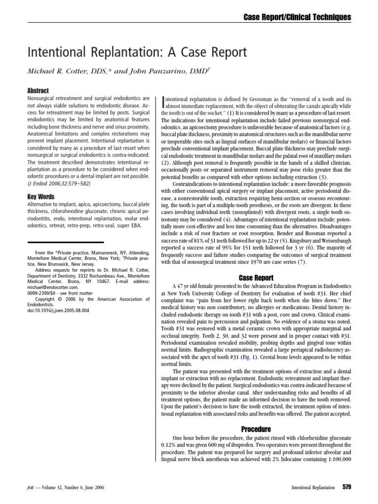 Intentional Replantation A Case Report Dental Implant Dentistry