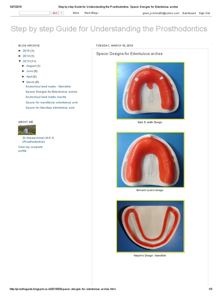 Step by step Guide for Understanding the Prosthodontics Spacer Designs